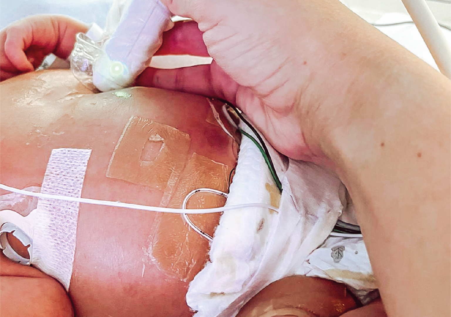 Curso y Taller Ecografía Point of Care (POCUS) en el Paciente Crítico Neonatal