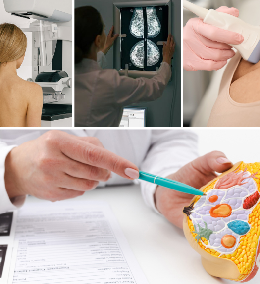 Curso Imágenes Mamarias: Basadas en los Escenarios Clínicos más Habituales